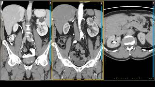 Picture Tests in Anatomy  Thorax  Mediastinum 2 [upl. by Elaine]