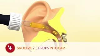 How to use Otex Olive Oil Ear Drops [upl. by Neom785]