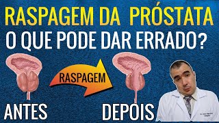 RASPAGEM DA PRÓSTATA as possíveis complicações dessa cirurgia [upl. by Nilam]