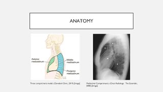 Mediastinal Masses [upl. by Vanthe]