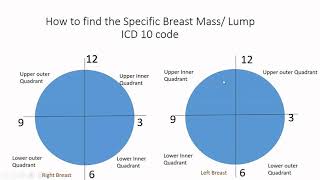 What Does It Mean to Have Dense Breasts [upl. by Earleen150]