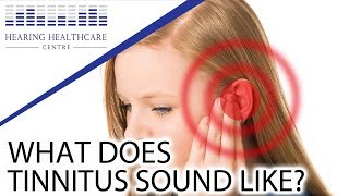 What Does Tinnitus Sound Like [upl. by Birchard]