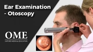 Otoscopy Ear Examination  ENT [upl. by Eldwon]