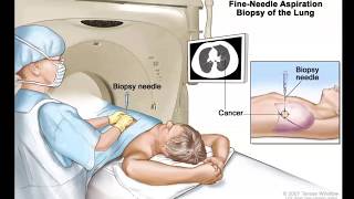 Mediastinum Lungs mediastinum and cardiac valves – Anatomy  Lecturio [upl. by Brand]