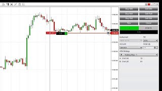 Configure an Automatic Trailing Stop [upl. by Jobye159]