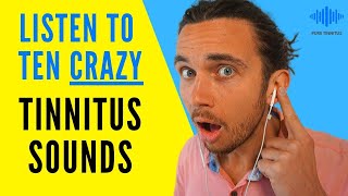 What Does Tinnitus Sound Like [upl. by Sicnarf323]