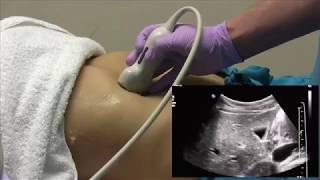 How I do it Ultrasound of the Abdomen [upl. by Hege]