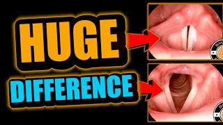 Singing amp Rapping Basics How Do Vocal Cords Work [upl. by Tammi]