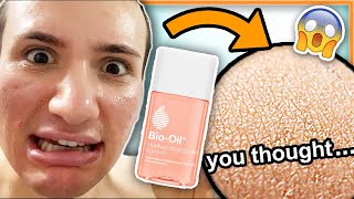 I tried BIO OIL on my face for ONE WEEK my mom really thought this was a miracle oil lol [upl. by Eceinwahs832]